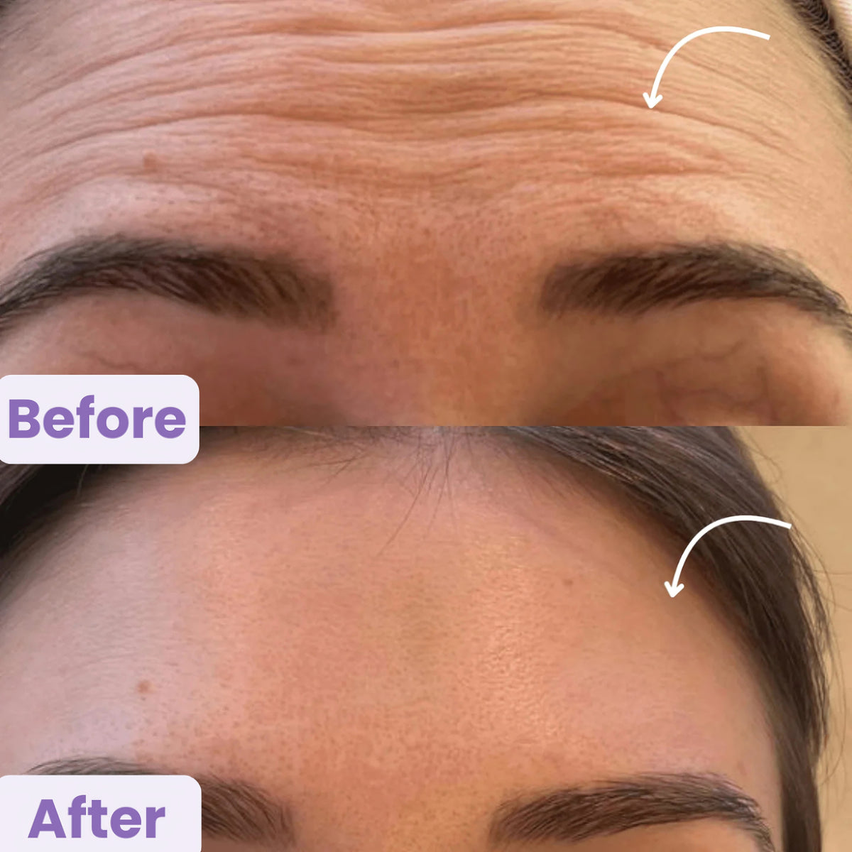 Lymphatic Contour Face Brush
